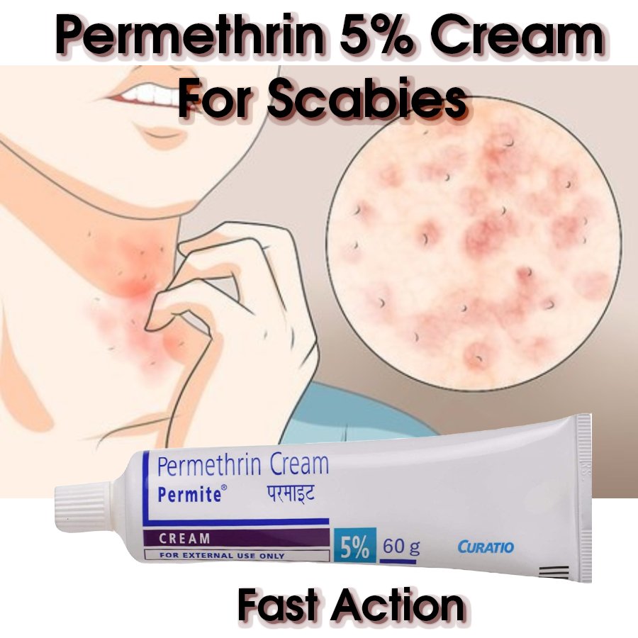 Permite 5 Anti Scabies and Lice cream 60gm in 1 tube anti sarna scabies permetrina