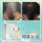 Ibling S-GLOW Collagen Prevent Hair Loss Care Treatment Support Hair, Skin, Nails