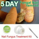 Nail Fungus Treatment Anti Fungal Nail Infection Essence Nail Treatment Removal