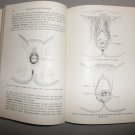 1945 Gynecology and Gynecologic Nursing Hardcover by Miller & Bryant Text Book