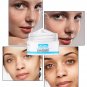 Freckle Whitening Face Cream Remove Melasma Pigment Melanin Acne Scar Dark Spots