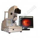 Canon DGi Digital Fundus Camera - Non Mydriatic