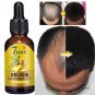Hair Growth Product . Hair Loss Oil Scalp Treatment For Men Women