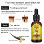 Hair Growth Product . Hair Loss Oil Scalp Treatment For Men Women