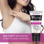 Crema Blanqueadora para piel blanquea manchas en cara axilas cuello entrepierna