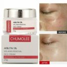 Alpha Arbutin 5% Anti Freckle Whitening Cream Fade Melasma Remove Spots Alpha Arbutin 5% Anti Freckle Whitening Cream Fade Melasma Remove Spots