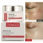 Alpha Arbutin 5% Anti Freckle Whitening Cream Fade Melasma Remove Spots
