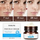 Whitening Freckle Cream Remove Melasma Pigment Melanin Acne Spot Dark Spots -NEW