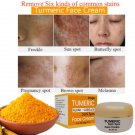 Turmeric Klear Complex Skin Glow Dark Spot Acne Spot Brown Spot Lightening Cream Turmeric Klear Complex Skin Glow Dark Spot Acne Spot Brown Spot Lightening Cream