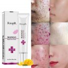 Rtopr Pimple Scar Acne Mark Spots Removal Treatment Gel Ointment Blemish Cream