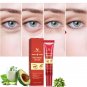 Crema Para Las Ojeras Anti-arrugas Remueve Bolsas en Los Ojos y Circulos Oscuros