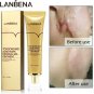 TCM Scar Removal Cream For Old Scars Stretch Mark Spots Gel for Men & Women