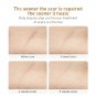 TCM Scar Removal Cream For Old Scars Stretch Mark Spots Gel for Men & Women
