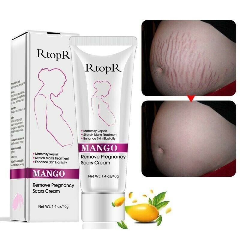 Crema Para Eliminar Estrias Previene Estrias En Abdomen Senos En El Embarazo