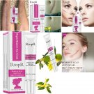 RtopR Acne Scar Removal Skin Repair Scar Cream Blackhead Acne Pimple Scar Cream