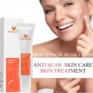 Scar Removal Cream Scar Repair Acne Mark Spots Surgery Scar Burn Marks Removal