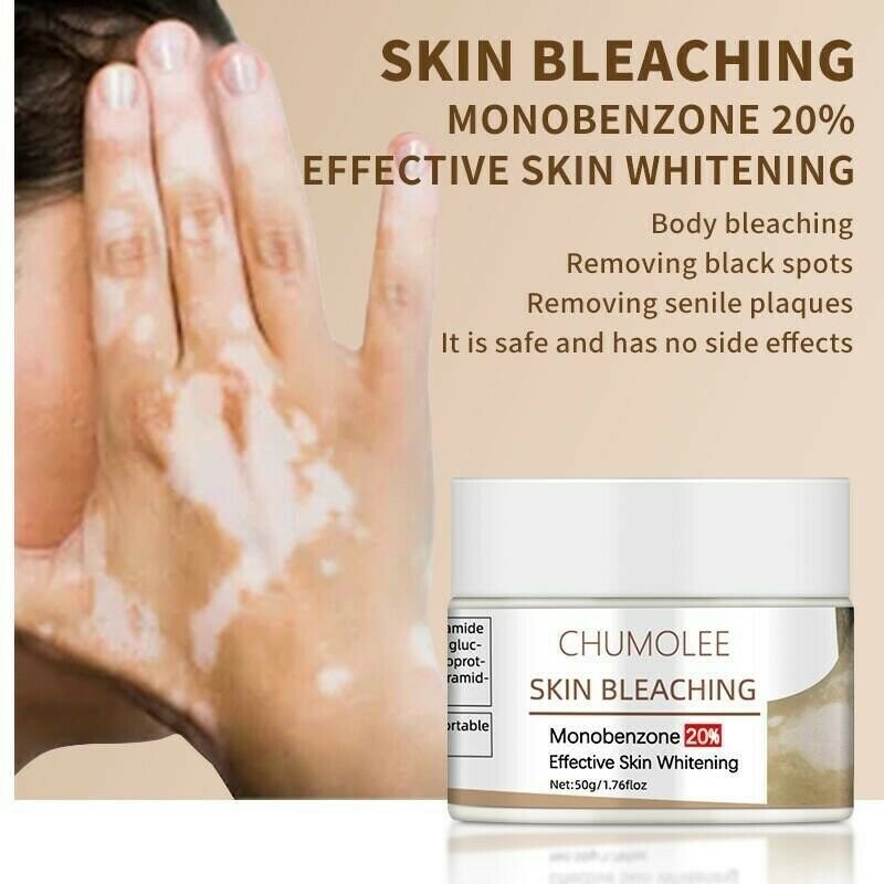 CHUMOLEE WHITE SPOT CREAM DARK KNUCKLES BLEACHING CREAM VITILIGO