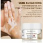 CHUMOLEE WHITE SPOT CREAM DARK KNUCKLES BLEACHING CREAM VITILIGO