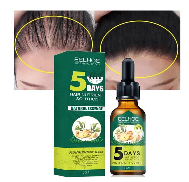 3 x Aceite De Jengibre Para Detener La Caida Del Cabello Estimula El Crecimiento