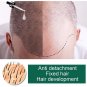 3 x Aceite De Jengibre Para Detener La Caida Del Cabello Estimula El Crecimiento