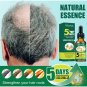 3 x Aceite De Jengibre Para Detener La Caida Del Cabello Estimula El Crecimiento