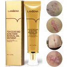 Crema cicatrizante para el acné Eliminación de cicatrices en la piel Cara de ... Crema cicatrizante para el acné Eliminación de cicatrices en la piel Cara de ...