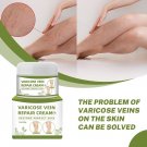 Crema Para Las Varices Borra Las Venas Varicosas Elimina Arañitas Del Capilar Crema Para Las Varices Borra Las Venas Varicosas Elimina Arañitas Del Capilar
