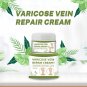 Crema Para Las Varices Borra Las Venas Varicosas Elimina Arañitas Del Capilar