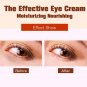 Nueva Esencia de Caracol Anti Arrugas Ojeras Crema de Ojos M&Atilde;&iexcl;s Suave para Arruga