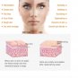 Crema eliminadora de pecas natural perlada mancha oscura mancha marron 25g
