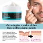 Men Wrinkle Cream - Crema Blanqueadora Para Hombre Elimina Manchas Y Acne De La Cara Crema Efectiva