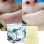 2 sets Sea Salt Soap Pimple Pores Acne Cleanser Soap Acne Face Wash