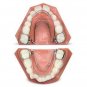 1x Mobile Intraoral Arch Quad Helix Upper Orthodontic Buccal Tube Bite Turbos