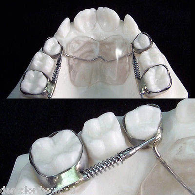 1set Molar Distalizer Dental Orthodontics