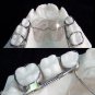 1set Molar Distalizer Dental Orthodontics