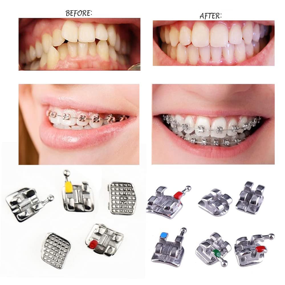 200Pc Roth Bracket Dental Orthodontic - Mini 022 Hook345 Roth