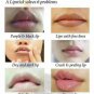 Authentic Legend Age Healthy Cherry Lipstick Natural Lip Balm/Mask ä¼ å¥ä»ç红樱æ¡å£çº¢(æ£