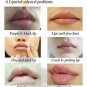 4 Authentic Legend Age Healthy Cherry Lipstick Natural Lip Balm/Mask ä¼ å¥ä»ç红樱æ¡å£çº¢æ£