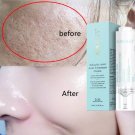 15ML AUQUEST Salicylic Acid Acne Treatment Face Cream Anti-acne Gel Shrink Pores