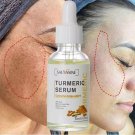 30ML Turmeric Face Serum Whitening Dark Spot Remover Acne Scar Bright Skin