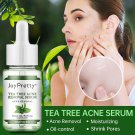 JoyPretty Tea Tree Facial Serum Acne Removal Hyaluronic Moisturizing Shrink Pores Oil-control