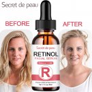 SDP 50ml Retinol Face Serum 2.5% With Hyaluronic Acid Anti Wrinkle Whitening Moisturizing