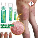 Herbal Antibacterial Cream Psoriasis Cream Itching Relief