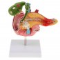 Life Size Anatomical Human Pancreas Duodenum Gallbladder Pathology Model