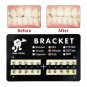 200Pcs Teeth Model Mini Roth Brackets Roth 022 Slot Bondable With Hook On 345