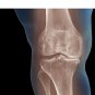 Bone Pain Capsules - Arthritis Pain Relief, Osteoarthritis, Knee & Bone Support