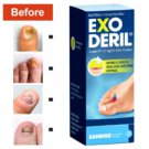 4 PACK Exoderil %1 Mycosis, Candida, Skin Corrugation Fungus Remedy 20 ML