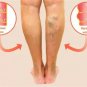 2 pack TROXEVASIN -2% gel - 40g For Varicose Veins Spider Venis