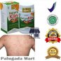 Original 1 Box (60 Capsules) Nature Klin Herbal Medicine Ringworm Itching Fungal Eczema Skin Health