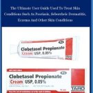 Clobetasol Propionate: The Ultimate User Guide Used To Treat Skin Conditions Such As Psoriasis, Seb